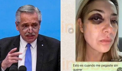 Fernández fez apelo à ex para falar &#039;o mínimo possível&#039; antes de audiência sobre fotos de agressão, diz site argentino