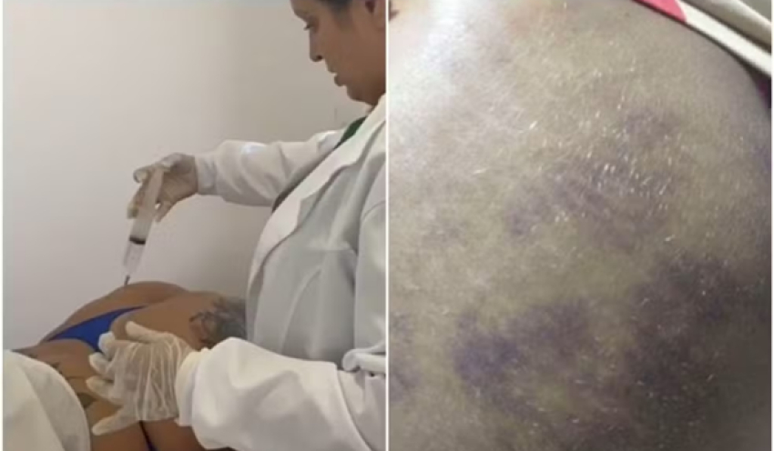 Falsa médica presa em João Pessoa pode responder por pelo menos quatro crimes, afirma delegado