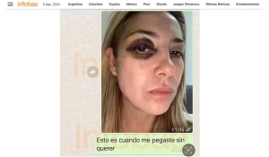 Alberto Fernández nega que tenha agredido ex-mulher em mensagem: &#039;Lamento que acredite que sou capaz de fazer algo assim&#039;