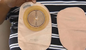 Lei garante prioridade de atendimento para pessoas ostomizadas em estabelecimentos da Paraíba