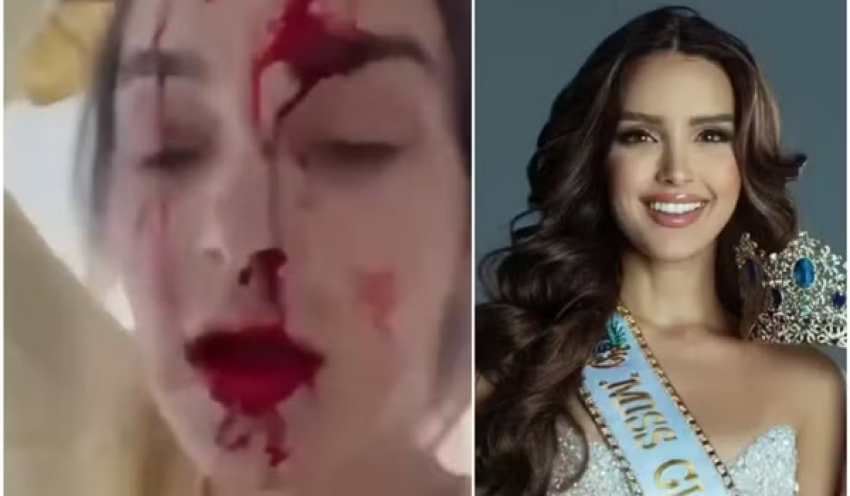 Miss Venezuela acusa o próprio estilista de agredi-la dentro de quarto de hotel em Cannes